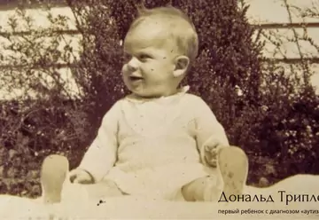 Первый ребёнок с диагнозом аутизм